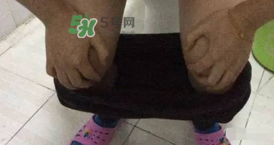 孕期可以蹲著上廁所嗎？孕期上廁所會壓到寶寶嗎？