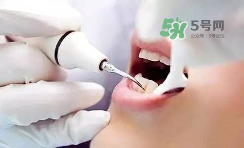 孕婦能矯正牙齒嗎？懷孕期間可以矯正牙齒嗎？