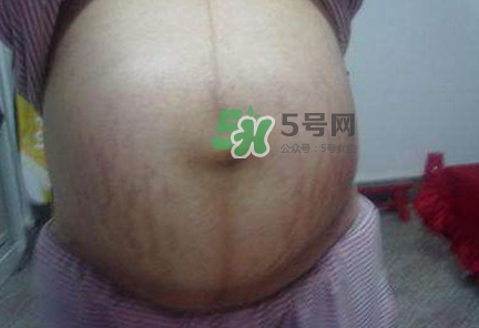 懷女孩肚子上會長毛嗎？懷女孩肚子特征圖片