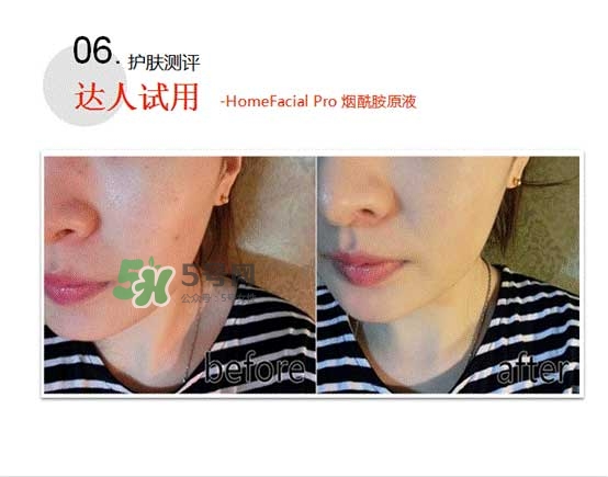 homefacialpro煙酰胺原液怎么樣？hfp煙酰胺原液好用嗎