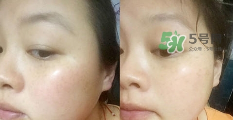 可思美潔面儀好不好用？可思美凈致潔顏聲波潔面儀怎么樣？