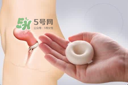 殺精劑有什么副作用？殺精劑的使用方法