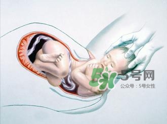 順產(chǎn)和剖腹產(chǎn)哪個(gè)好？順產(chǎn)和剖腹產(chǎn)哪個(gè)痛？