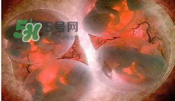 多胞胎是怎么生產(chǎn)的？多胞胎應(yīng)選擇什么分娩方式