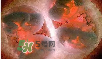 多胞胎順產(chǎn)怎么生？多胞胎剖腹產(chǎn)和單胎剖腹產(chǎn)的區(qū)別
