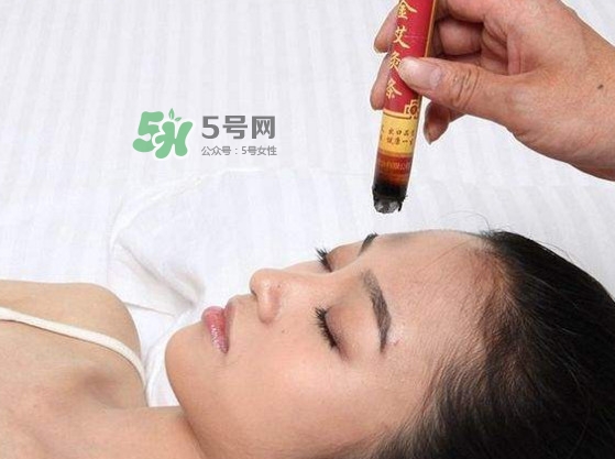 艾灸會(huì)不會(huì)過(guò)敏？艾灸過(guò)敏怎么辦