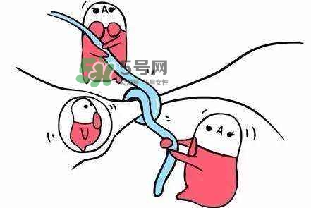 結(jié)扎好還是上環(huán)好？結(jié)扎上環(huán)哪個危害??？