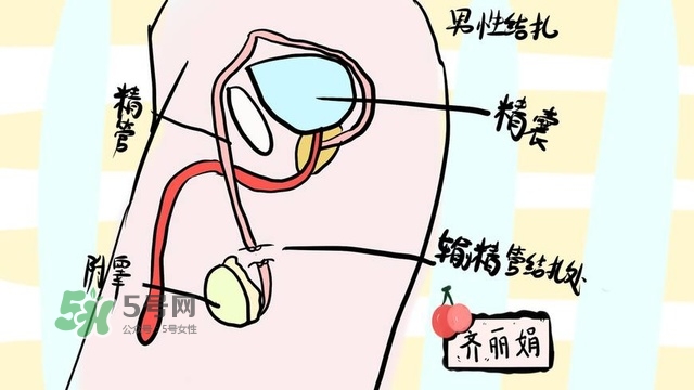 生完二胎一定要結(jié)扎嗎？生完二胎結(jié)扎好不好？