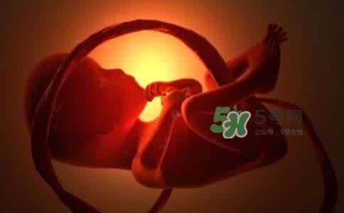 寶寶臍帶繞頸只能剖腹產(chǎn)嗎？胎兒臍帶繞頸孕婦有什么感覺