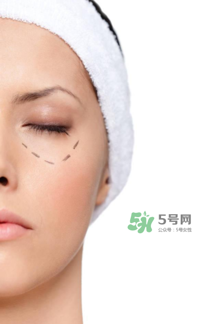 近視手術(shù)多少度不能做？多少度可以做近視手術(shù)？