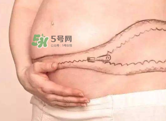 剖腹產(chǎn)疤痕怎么去除？剖腹產(chǎn)疤痕能去掉嗎？