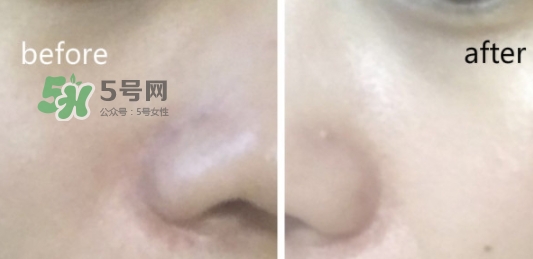 hr綠寶瓶新肌水怎么用？赫蓮娜綠寶瓶新肌水使用方法
