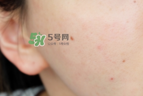 臘梅是什么牌子？臘梅是什么護(hù)膚品