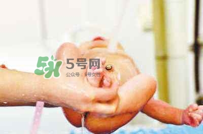 羊水栓塞是醫(yī)療事故嗎？羊水栓塞多發(fā)生于順產(chǎn)還是剖腹產(chǎn)？