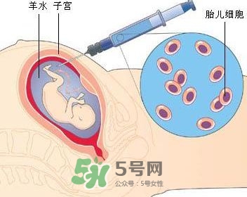 羊水栓塞是怎么回事？羊水栓塞怎么預(yù)防？