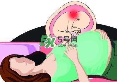 孕婦左側(cè)臥睡不著怎么辦？孕期左側(cè)睡不舒服怎么辦？