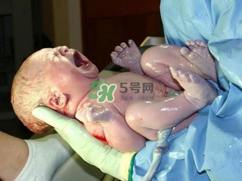 順產(chǎn)有多疼？順產(chǎn)的疼痛可以忍受嗎？