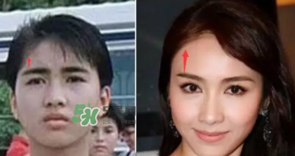 發(fā)際線低怎么調(diào)整？標(biāo)準(zhǔn)的發(fā)際線圖片