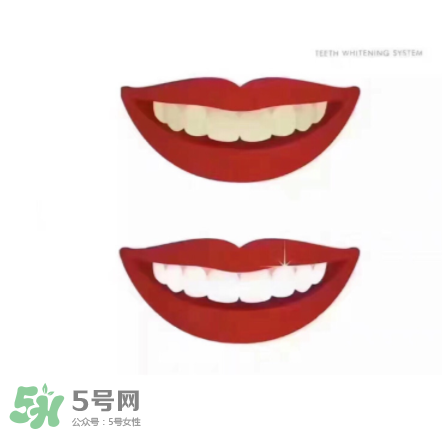 美牙儀能帶上飛機(jī)嗎？美牙儀可以過(guò)安檢嗎？