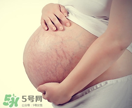 孕婦胸部長(zhǎng)妊娠紋嗎？胸部長(zhǎng)妊娠紋了怎么辦？