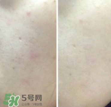 美康粉黛氣墊bb怎么樣？美康粉黛氣墊bb毀容