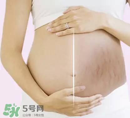 長妊娠紋的前兆 長妊娠紋很癢怎么辦？