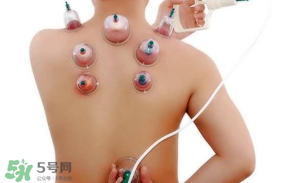 火罐和真空罐哪個(gè)好？真空罐和火罐效果一樣好嗎