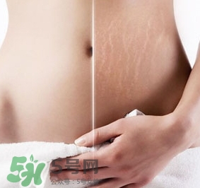 妊娠紋什么時(shí)候變白？妊娠紋產(chǎn)品什么時(shí)候用？