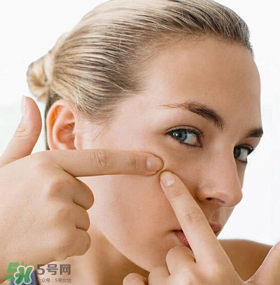 長(zhǎng)痘長(zhǎng)閉口怎么辦？長(zhǎng)痘長(zhǎng)閉口是什么原因？