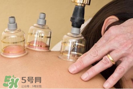 真空拔罐有用嗎？真空拔罐多長時間合適