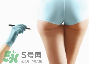 吸脂減肥副作用有哪些？吸脂減肥可靠嗎？
