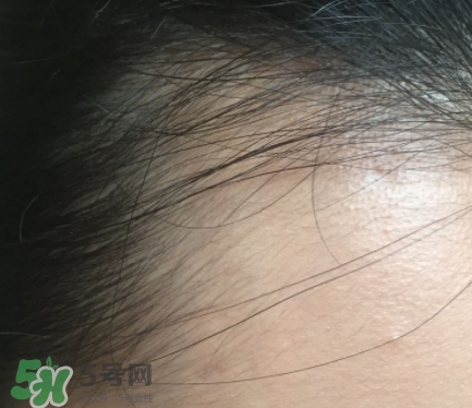 發(fā)際線粉要卸妝嗎_怎么卸？
