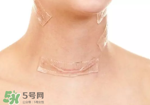 硅膠疤痕貼有用嗎？硅膠疤痕貼效果怎么樣？
