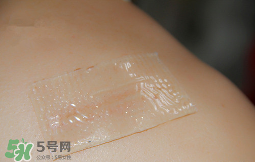仙卡疤痕貼有用嗎？仙卡疤痕貼效果怎么樣？