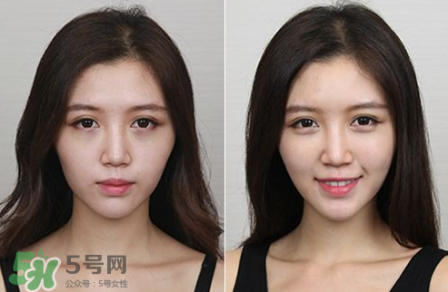 蘋果肌怎么化？蘋果肌究竟哪里好？