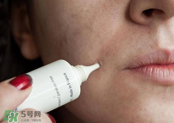 痤瘡的分類(lèi) 痤瘡的護(hù)理原則