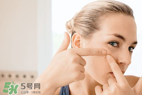 暗瘡可以擠壓嗎？油性和骯臟肌膚會容易有暗瘡嗎？