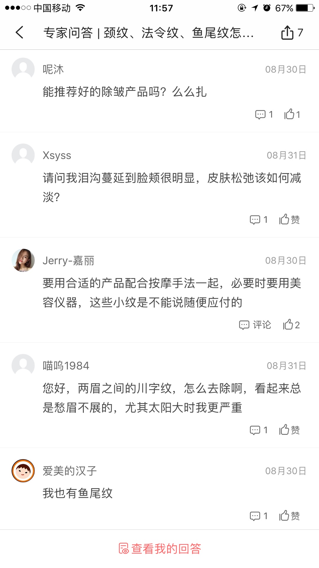 天生的魚(yú)尾紋怎么去除或淡化
