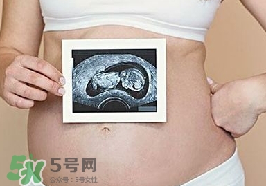 雙子宮可以上環(huán)嗎？雙子宮上環(huán)要注意哪些？