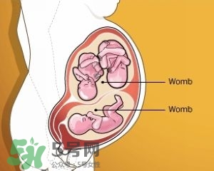 雙子宮是什么意思？雙子宮可以順產(chǎn)嗎？