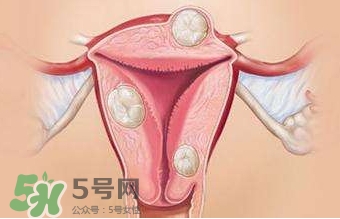 雙子宮可以上環(huán)嗎？雙子宮上環(huán)要注意哪些？