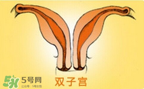 雙子宮是什么意思？雙子宮可以順產(chǎn)嗎？
