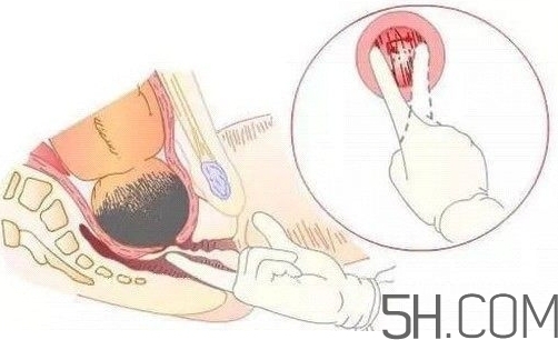 內(nèi)檢是什么感覺(jué)？?jī)?nèi)檢有男醫(yī)生嗎？
