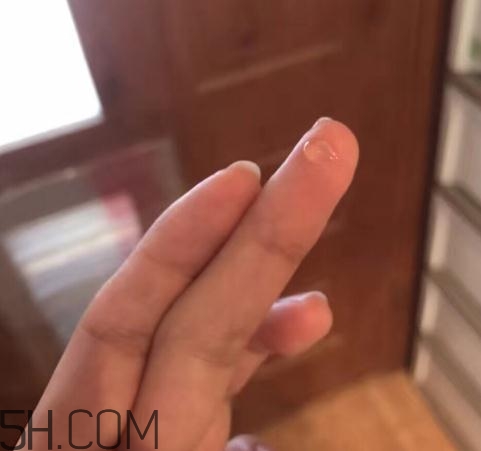 倍舒痕可以去痘印嗎？倍舒痕能涂在痘痘上嗎？