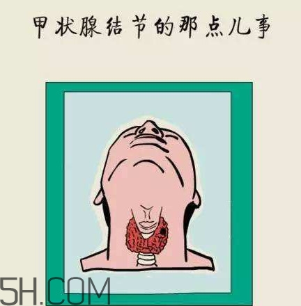為什么會(huì)得甲狀腺結(jié)節(jié)？甲狀腺節(jié)結(jié)是什么？