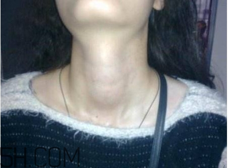 甲狀腺結(jié)節(jié)掛什么科？甲狀腺結(jié)節(jié)可以懷孕嗎