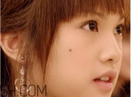 痣是怎么形成的？女人痣長哪里最有福氣