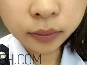 小蜜蜂細致修護唇膏很油嗎？夏天用合適嗎？