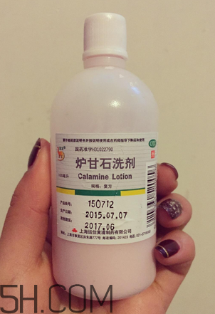 爐甘石洗劑多少錢一瓶？爐甘石洗劑治痤瘡嗎？