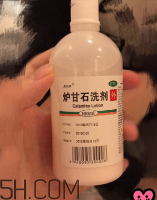 爐甘石洗劑是洗還是擦？爐甘石洗劑是什么顏色？